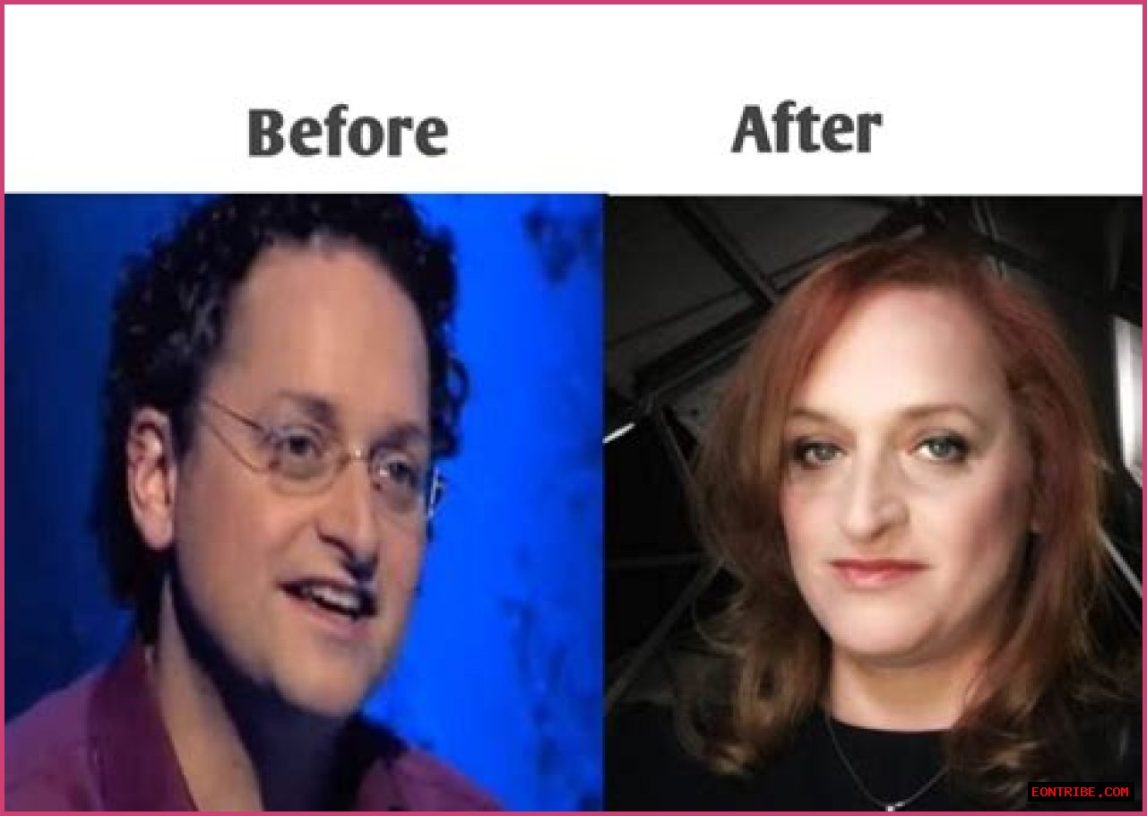 Dr. Lynette Nusbacher Before And After: A Journey Of Transformation