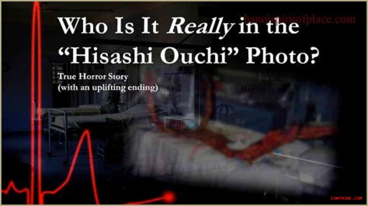 Hisashi Ouchi: The Tragic Story Behind The Real Picture