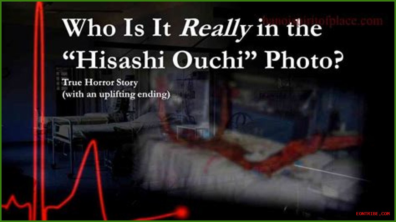 Unraveling The Mystery Of Hisashi Ouchi's Corpse: A Journey Through Tragedy And Science