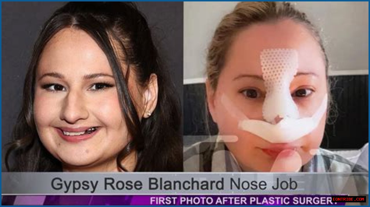 Unveiling The Transformation: The Nose Job Of Gypsy Rose
